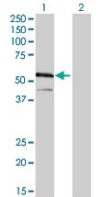 Western Blot: IRF4 Antibody (2F2) [H00003662-M02]