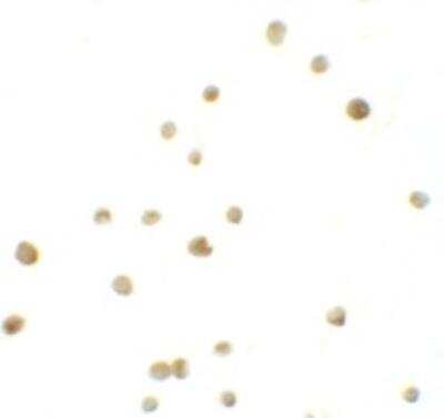 Immunocytochemistry/ Immunofluorescence: IRF4 Antibody - BSA Free [NBP1-76574]