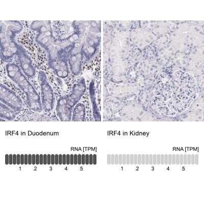 Immunohistochemistry-Paraffin: IRF4 Antibody [NBP1-82813]