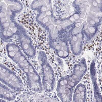 Immunohistochemistry-Paraffin: IRF4 Antibody [NBP1-82813]