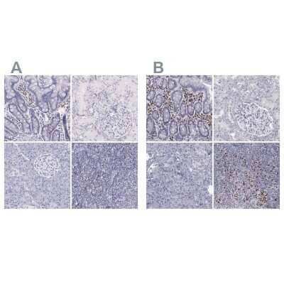 Immunohistochemistry-Paraffin: IRF4 Antibody [NBP1-82813]