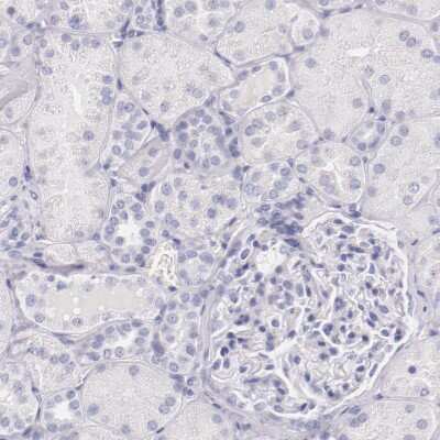 Immunohistochemistry-Paraffin: IRF4 Antibody [NBP1-82813]