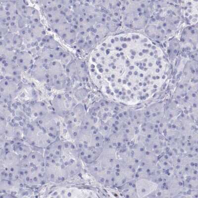 Immunohistochemistry-Paraffin: IRF4 Antibody [NBP1-82813]