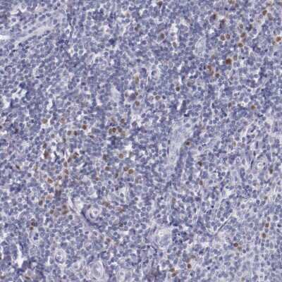 Immunohistochemistry-Paraffin: IRF4 Antibody [NBP1-82813]