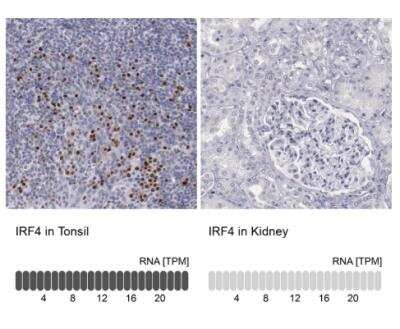 Immunohistochemistry-Paraffin: IRF4 Antibody [NBP1-82814]