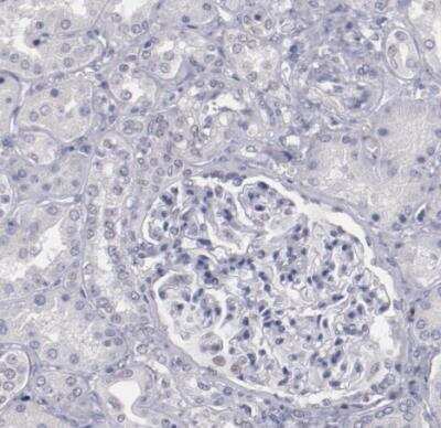 Immunohistochemistry-Paraffin: IRF4 Antibody [NBP1-82814]