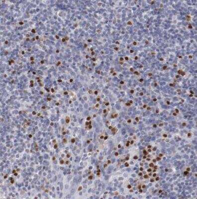 Immunohistochemistry-Paraffin: IRF4 Antibody [NBP1-82814]
