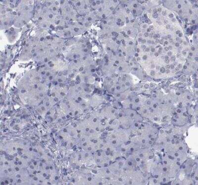 Immunohistochemistry-Paraffin: IRF4 Antibody [NBP1-82814]