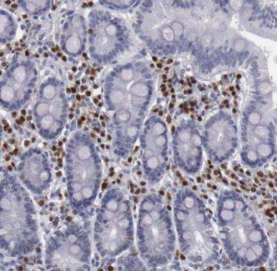 Immunohistochemistry-Paraffin: IRF4 Antibody [NBP1-82814]