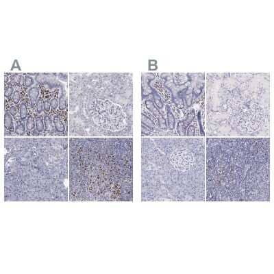 Immunohistochemistry-Paraffin: IRF4 Antibody [NBP1-82814]