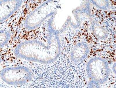 Immunohistochemistry-Paraffin: IRF4 Antibody (RM352) [NBP2-77422]