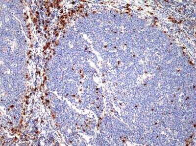 Immunohistochemistry-Paraffin: IRF4 Antibody (RM352) [NBP2-77422]