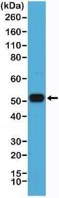 Western Blot: IRF4 Antibody (RM352) [NBP2-77422]