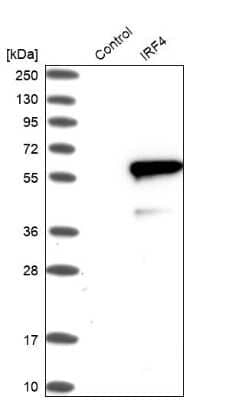 Western Blot: IRF4 Antibody [NBP1-82813]