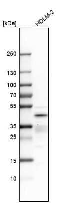 Western Blot: IRF4 Antibody [NBP1-82814]