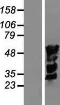 Western Blot: IRF4 Overexpression Lysate [NBL1-12033]