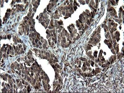 Immunohistochemistry: IRF5 Antibody (OTI1G7) [NBP2-45425]