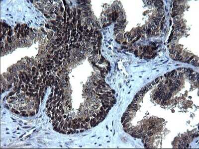 Immunohistochemistry: IRF5 Antibody (OTI1G7) [NBP2-45425]