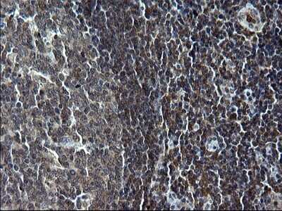 Immunohistochemistry: IRF5 Antibody (OTI1G7) [NBP2-45425]