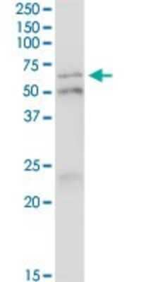 Immunoprecipitation: IRF5 Antibody (1H6) [H00003663-M03]