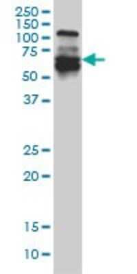 Western Blot: IRF5 Antibody (1H6) [H00003663-M03]