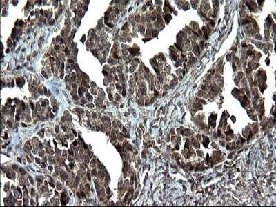 Immunohistochemistry: IRF5 Antibody (OTI1G7) - Azide and BSA Free [NBP2-71043]