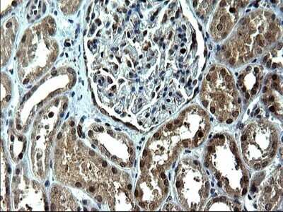 Immunohistochemistry: IRF5 Antibody (OTI1G7) - Azide and BSA Free [NBP2-71043]
