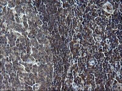 Immunohistochemistry: IRF5 Antibody (OTI1G7) - Azide and BSA Free [NBP2-71043]