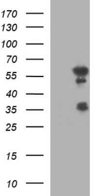 Western Blot: IRF5 Antibody (OTI1G7)Azide and BSA Free [NBP2-71043]