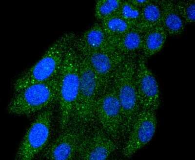 Immunocytochemistry/ Immunofluorescence: IRF5 Antibody (SD203-07) [NBP2-67742]