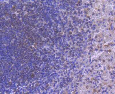Immunohistochemistry-Paraffin: IRF5 Antibody (SD203-07) [NBP2-67742]