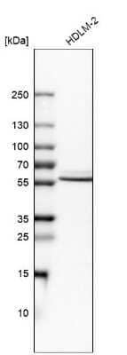 Western Blot: IRF5 Antibody [NBP2-14128]