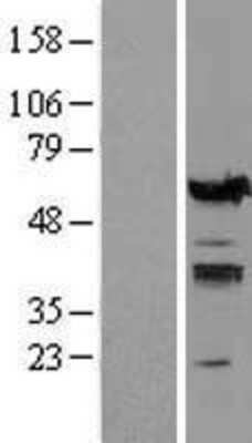 Western Blot: IRF5 Overexpression Lysate [NBL1-12035]