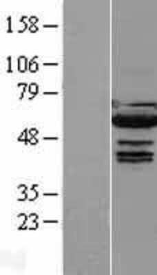 Western Blot: IRF5 Overexpression Lysate [NBP2-08322]