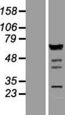 Western Blot: IRF5 Overexpression Lysate [NBP2-09302]