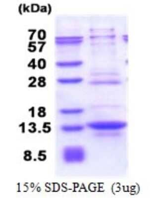 SDS-PAGE: Recombinant Human IRF5 His Protein [NBP2-51630]