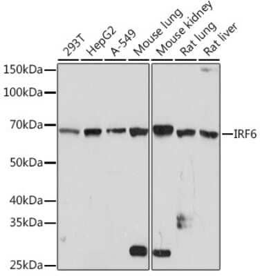 Western Blot: IRF6 Antibody (5D1Z4) [NBP3-16155]