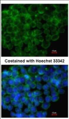 Immunocytochemistry/ Immunofluorescence: IRF6 Antibody [NBP2-16990]