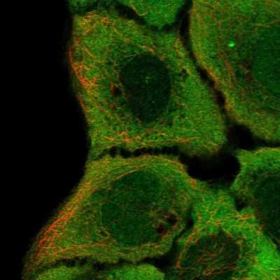 Immunocytochemistry/ Immunofluorescence: IRF6 Antibody [NBP2-49383]