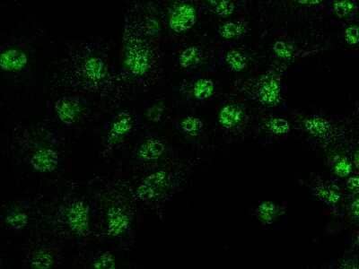 Immunocytochemistry/ Immunofluorescence: IRF6 Antibody [NBP2-98729]