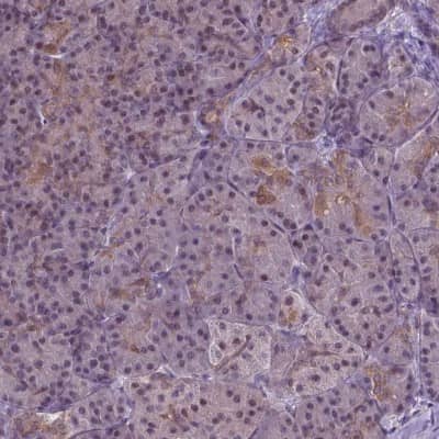 Immunohistochemistry-Paraffin: IRF6 Antibody [NBP2-49383]