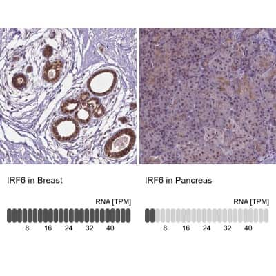 Immunohistochemistry-Paraffin: IRF6 Antibody [NBP2-49383]