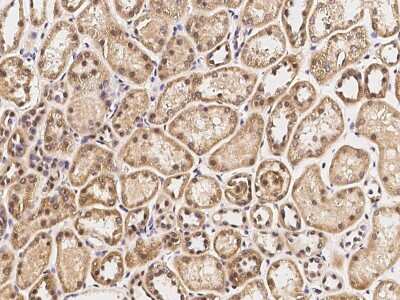 Immunohistochemistry-Paraffin: IRF6 Antibody [NBP2-99072]