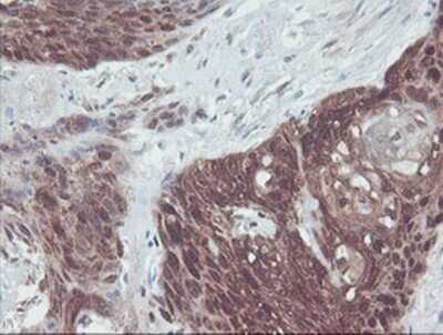 Immunohistochemistry: IRF6 Antibody (OTI2C10) - Azide and BSA Free [NBP2-71044]