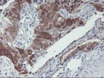 Immunohistochemistry: IRF6 Antibody (OTI2C10) - Azide and BSA Free [NBP2-71044]