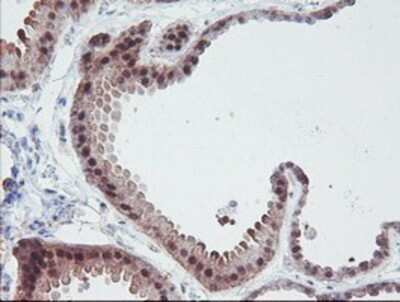 Immunohistochemistry: IRF6 Antibody (OTI2C10) - Azide and BSA Free [NBP2-71044]