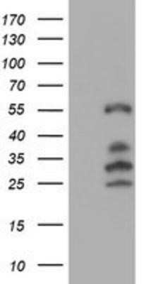 Western Blot: IRF6 Antibody (OTI2C10)Azide and BSA Free [NBP2-71044]