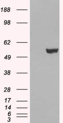 Western Blot: IRF6 Antibody [NBP1-51911]