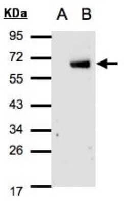 Western Blot: IRF6 Antibody [NBP2-16990]