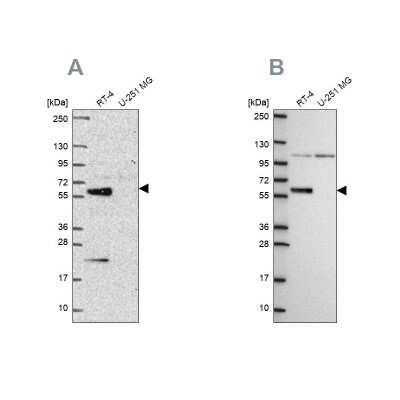 Western Blot: IRF6 Antibody [NBP2-49383]